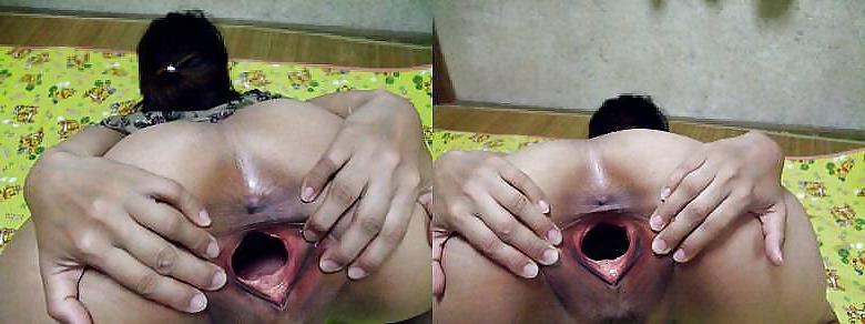 25P -MOST EXTREME- WRECKED & GAPED HOLES! BE CAREFUL!-L1390-