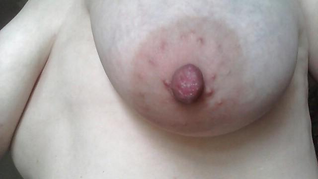 25P Huge Thick Nipples