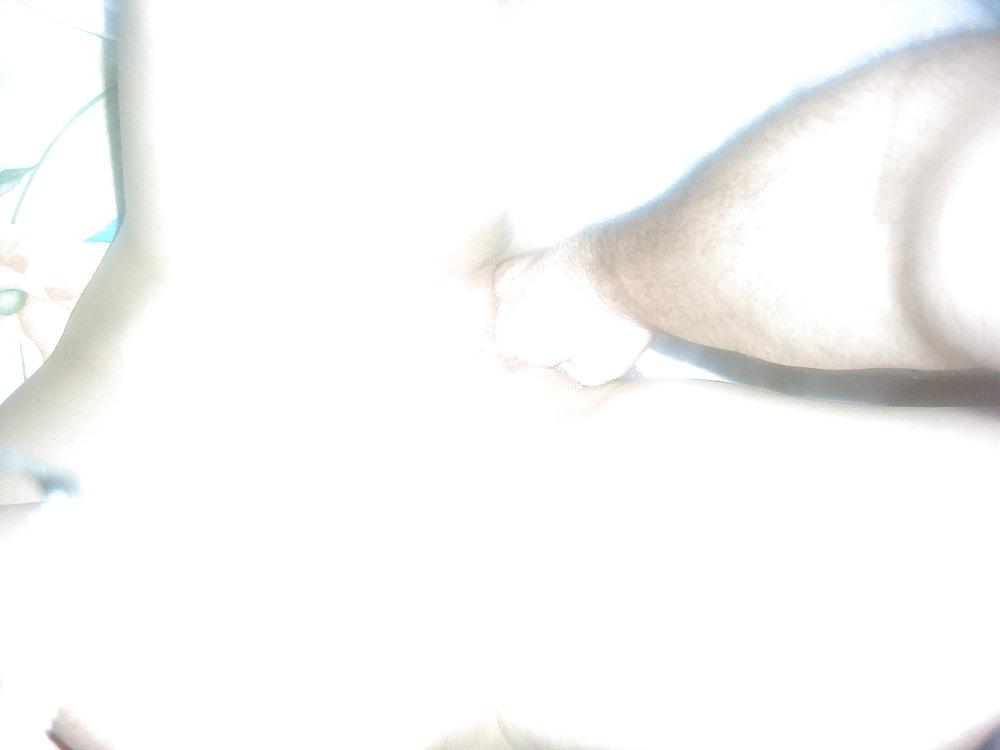 20P Insercion vaginal 