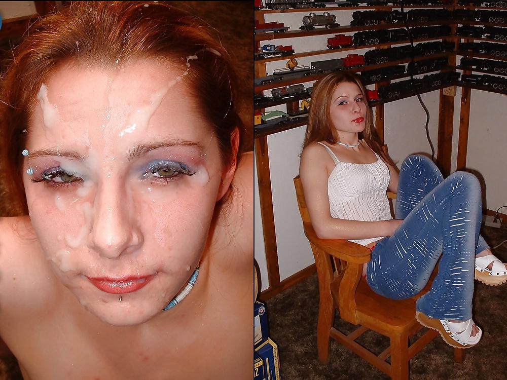 25P Vor, während und nach der Gesichtsbehandlung