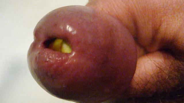 15P Vege insertion