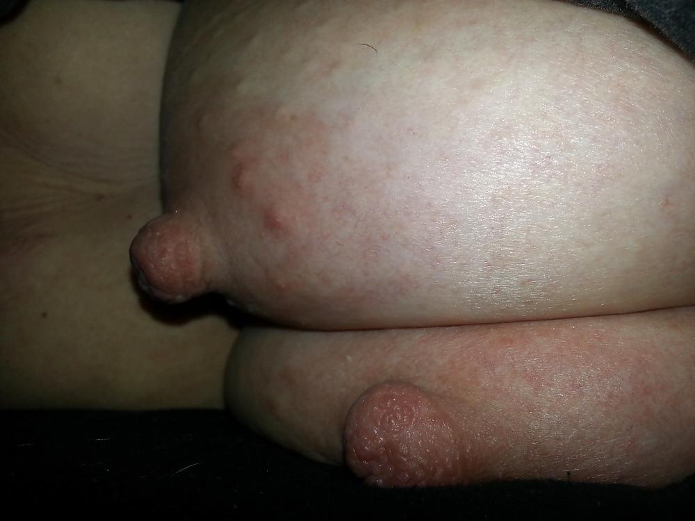 10P Nipples
