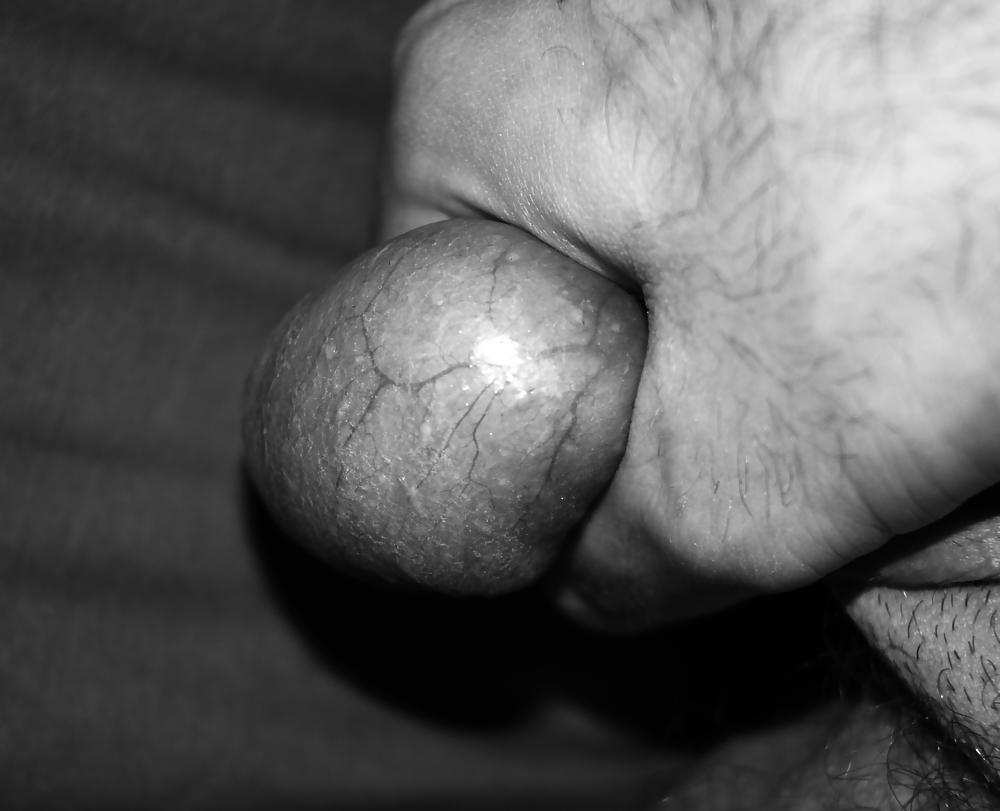 11P Dick & balls