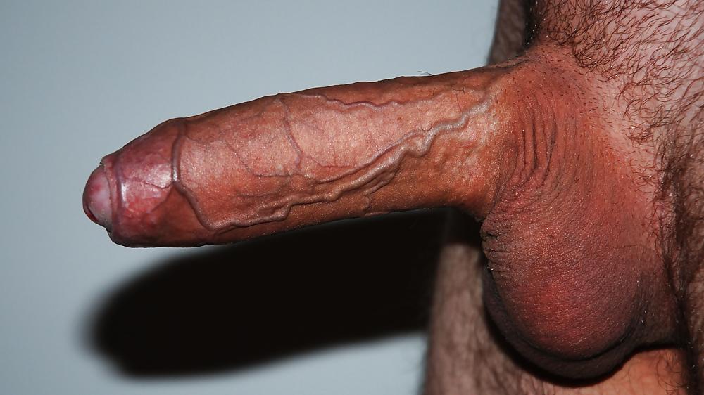 11P Dick & balls
