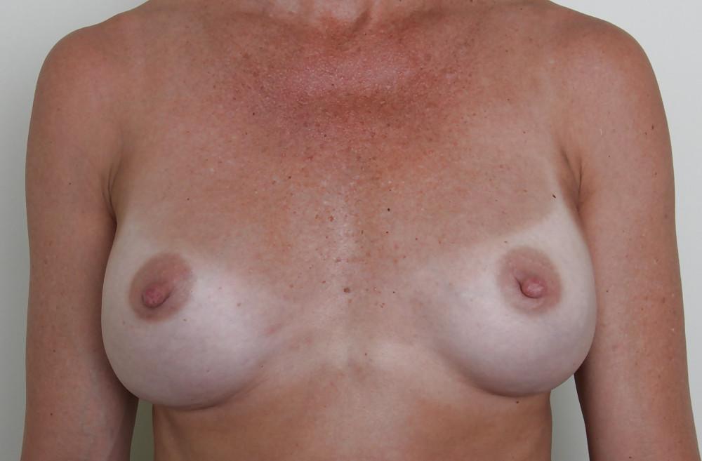 25P Nipples, Teats, Brustwarzen, Nippel, Zitzen III