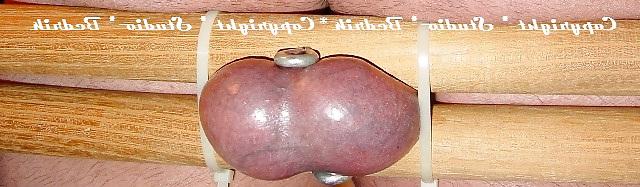 9P Stretched balls as Humbler by Bedrik