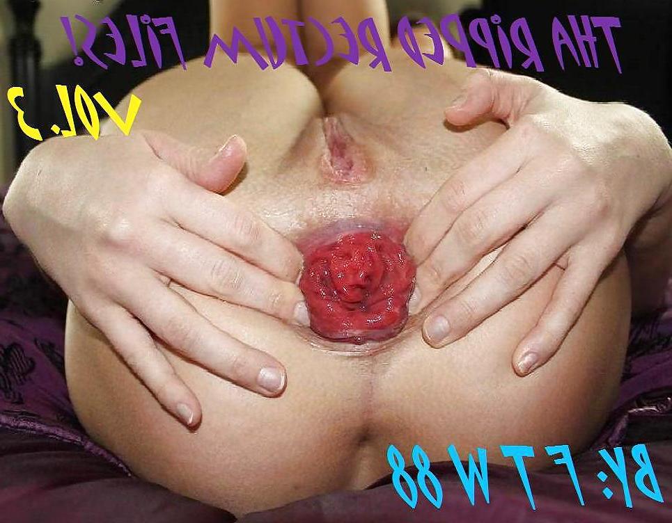 25P Tha Ripped Rectum Files! Vol.3 - By: FTW88