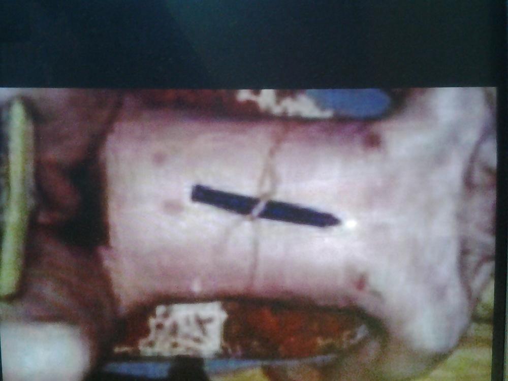 6P Swiss lopette encore punie
