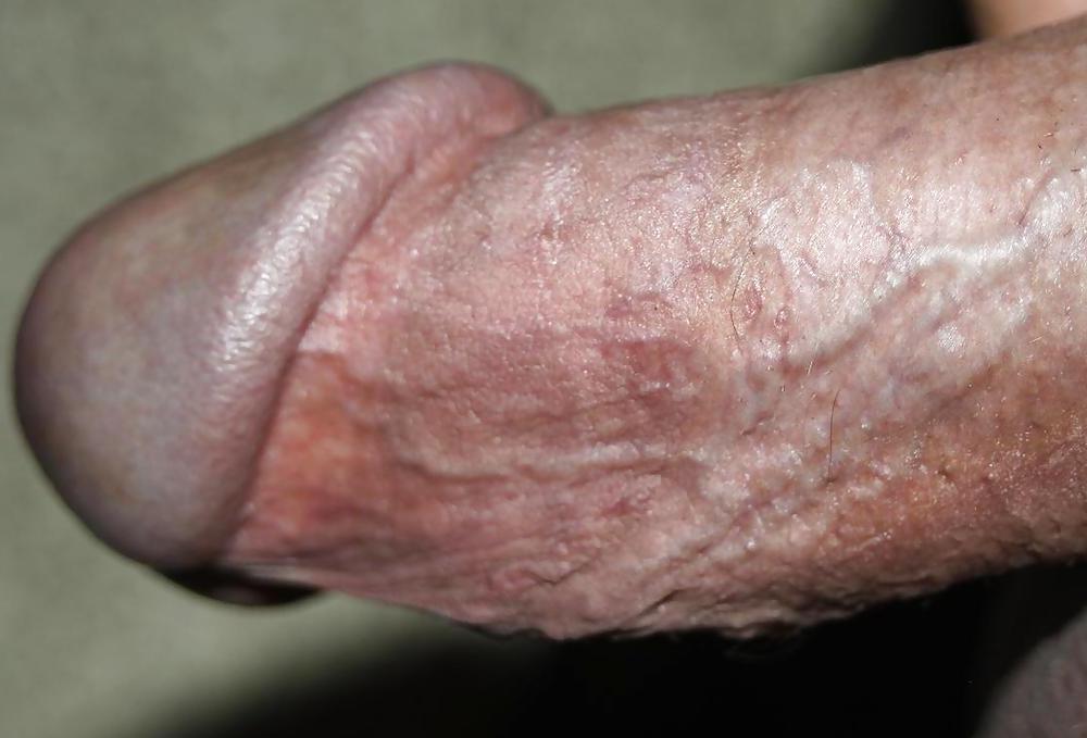 25P CBT : Huge Balls Beat With Rubber Bands!