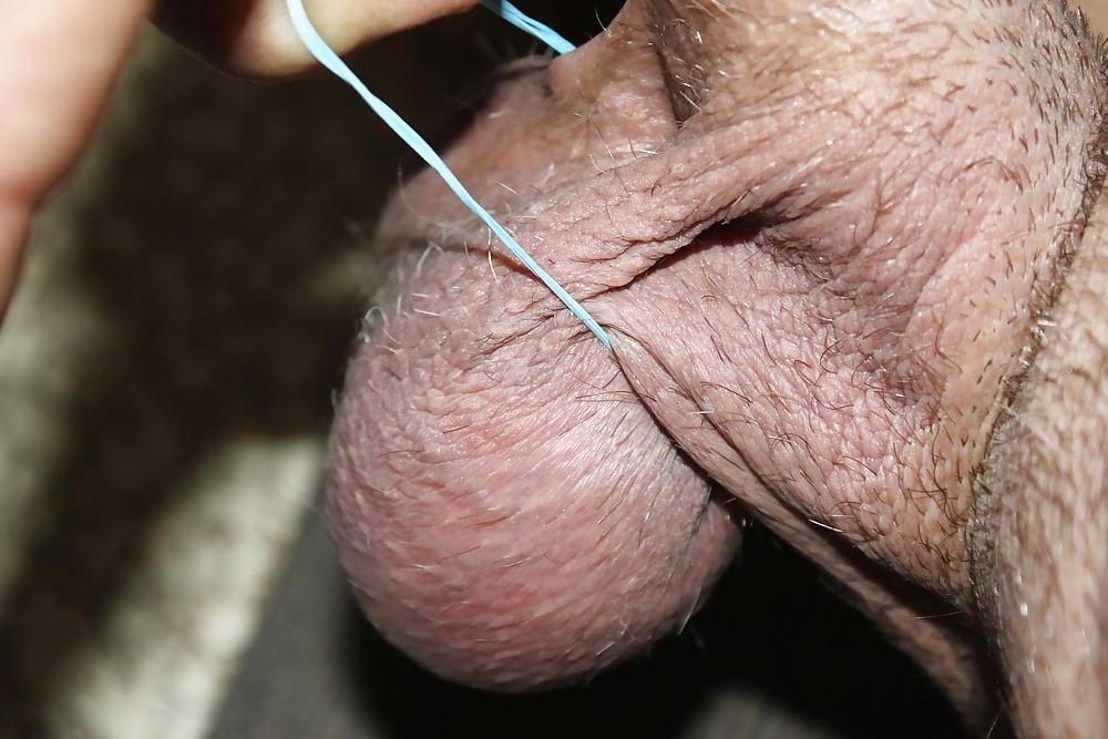 25P CBT : Huge Balls Beat With Rubber Bands!