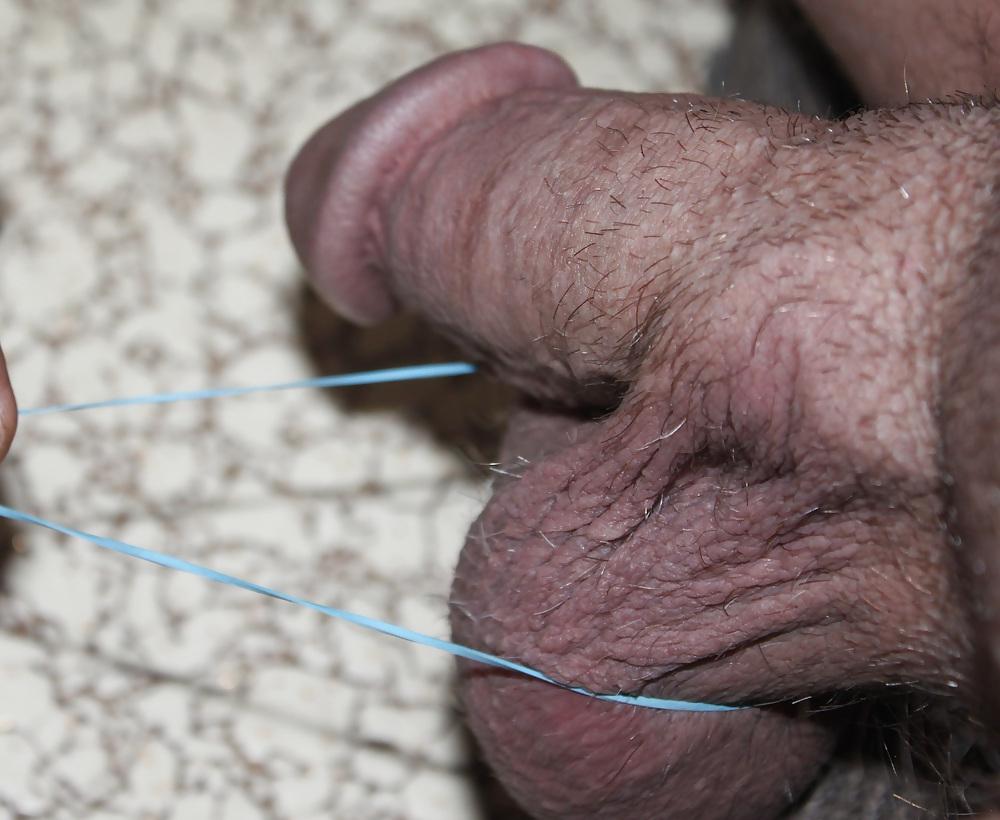 25P CBT : Huge Balls Beat With Rubber Bands!