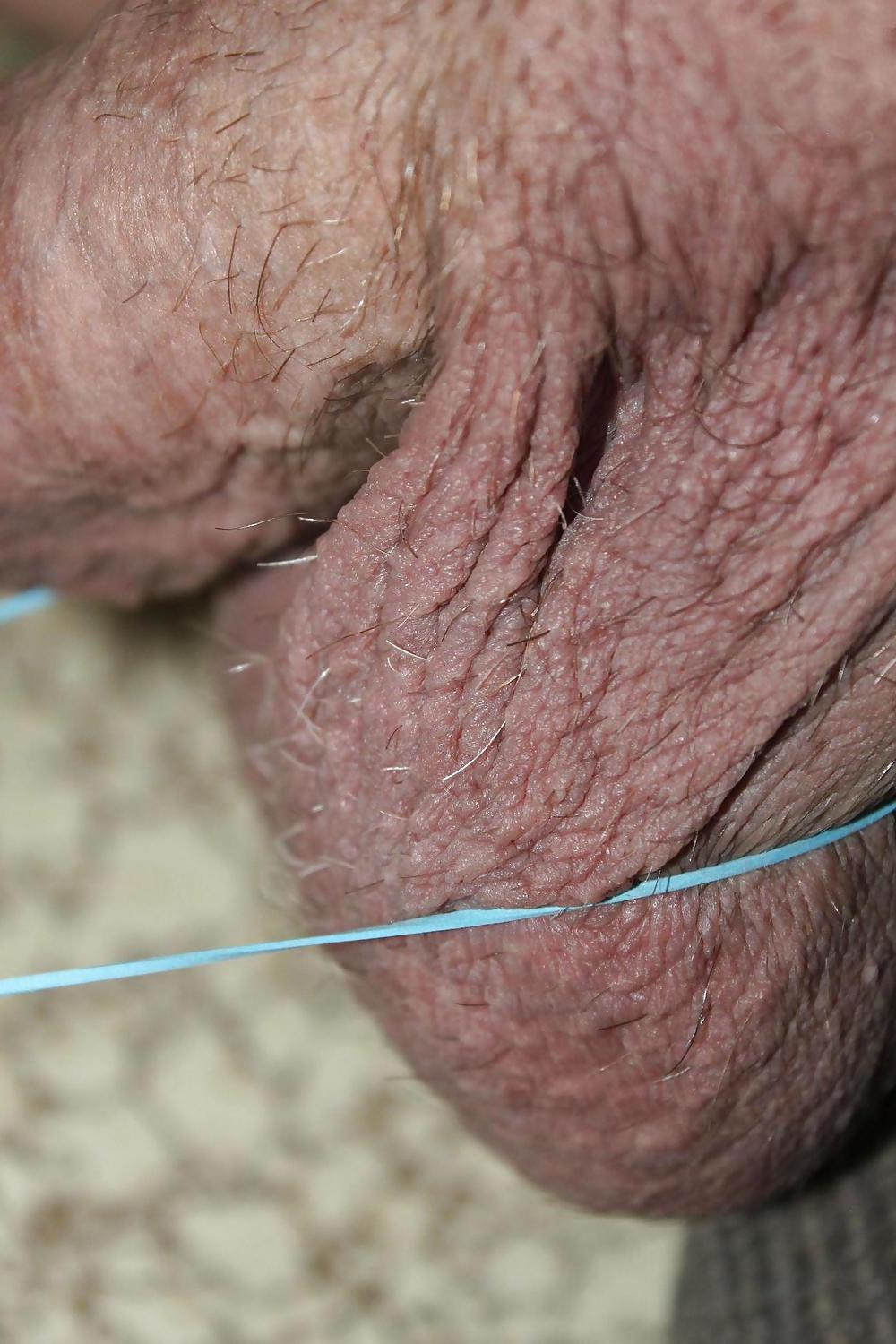 25P CBT : Huge Balls Beat With Rubber Bands!