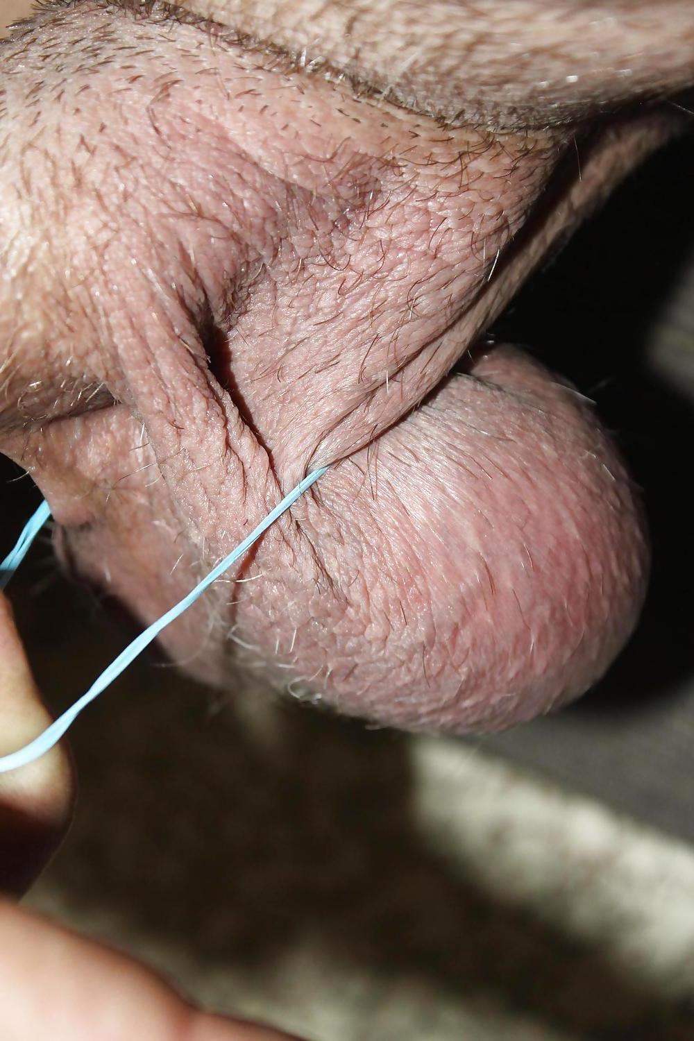 25P CBT : Huge Balls Beat With Rubber Bands!