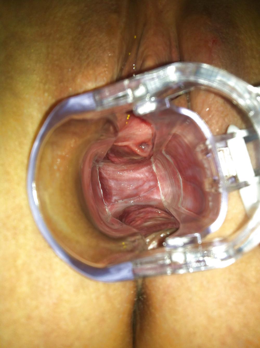 10P Girl extrem anal, fist, fuck 