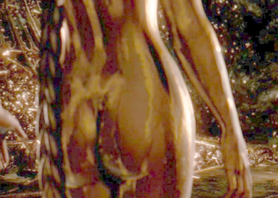 25P Celebs Naked 01