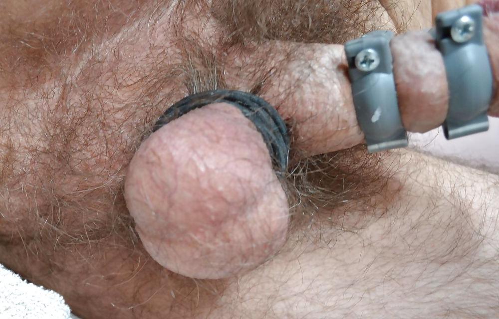 7P Hairy balls