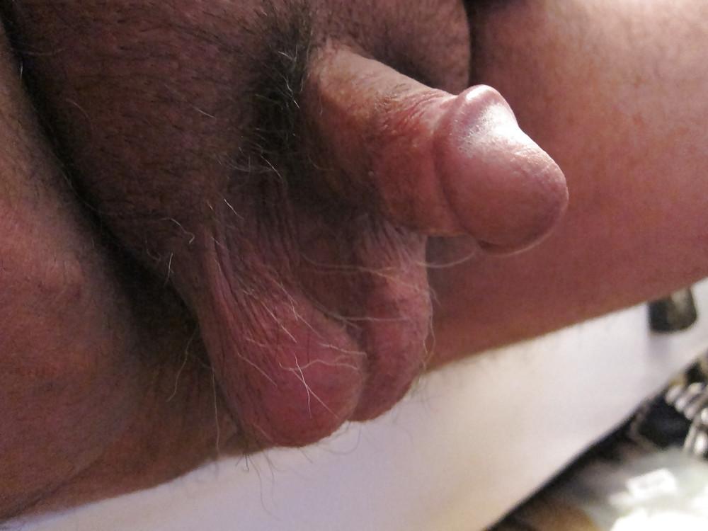 12P Low Hanging Balls