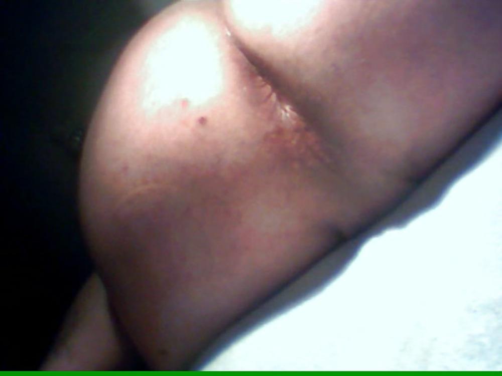 15P Hot anal!! bottle 0,5l deep in my ass!! 