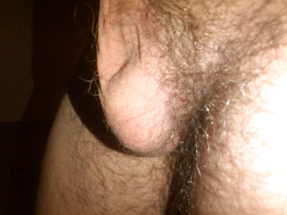 10P My balls