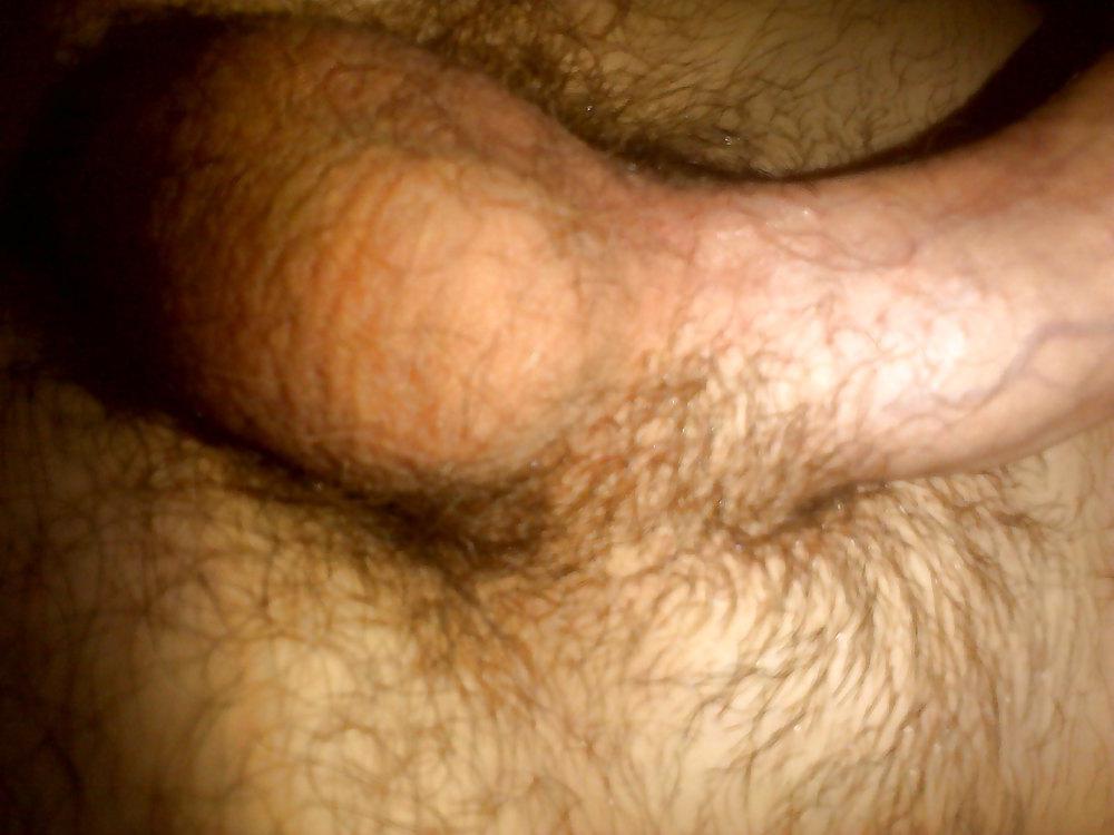 10P My balls