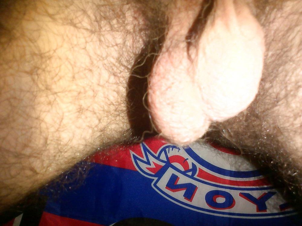 10P My balls