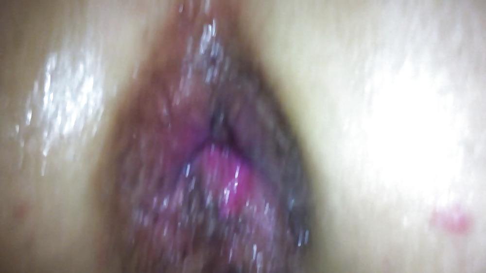 12P GAPE ANAL