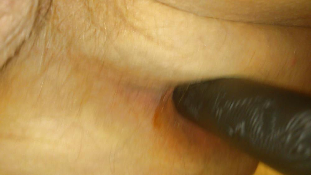 9P Tied upp balls and dick and anal fun