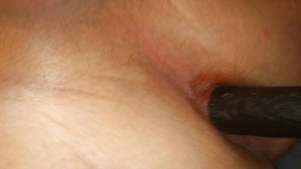 9P Tied upp balls and dick and anal fun