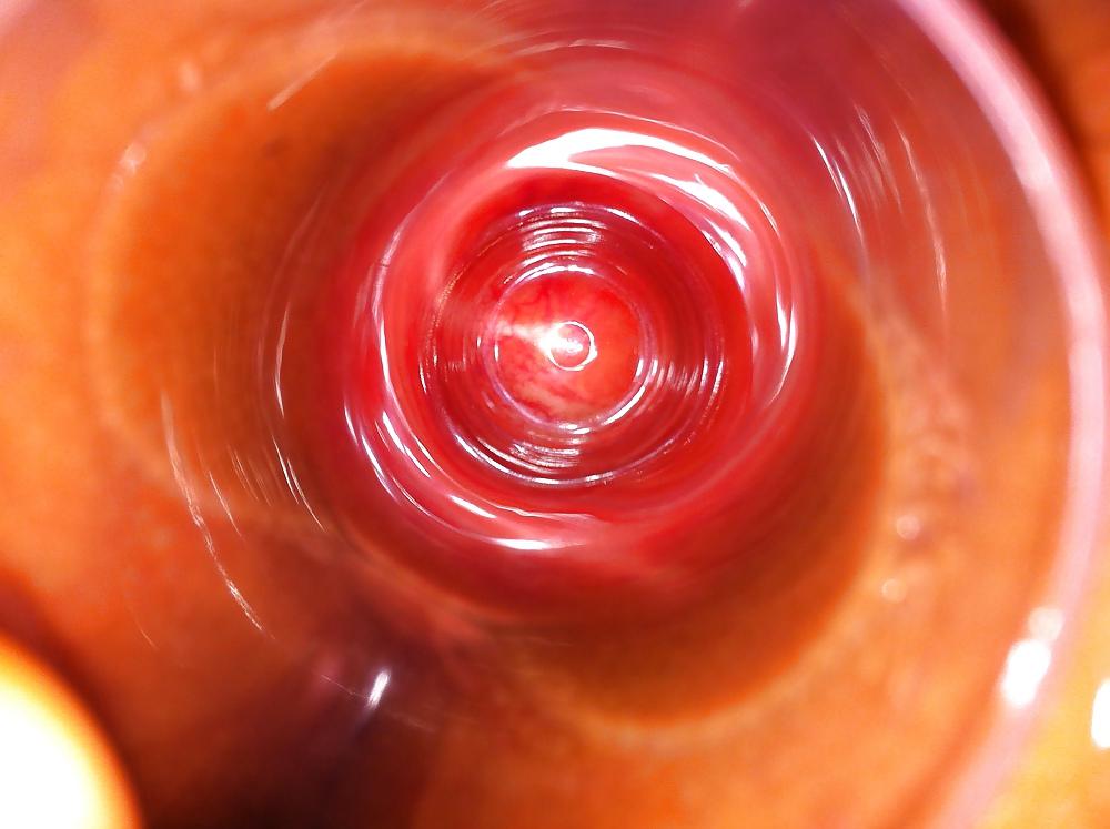 23P TOPBICHE anal gape with plastic tube... deep  deep deep....