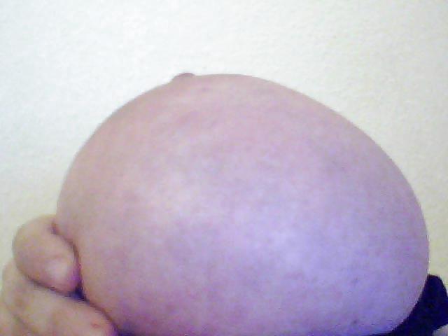 7P Bound Breast