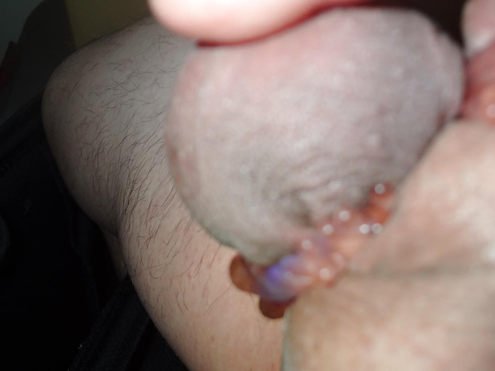 12P The urethra insertion