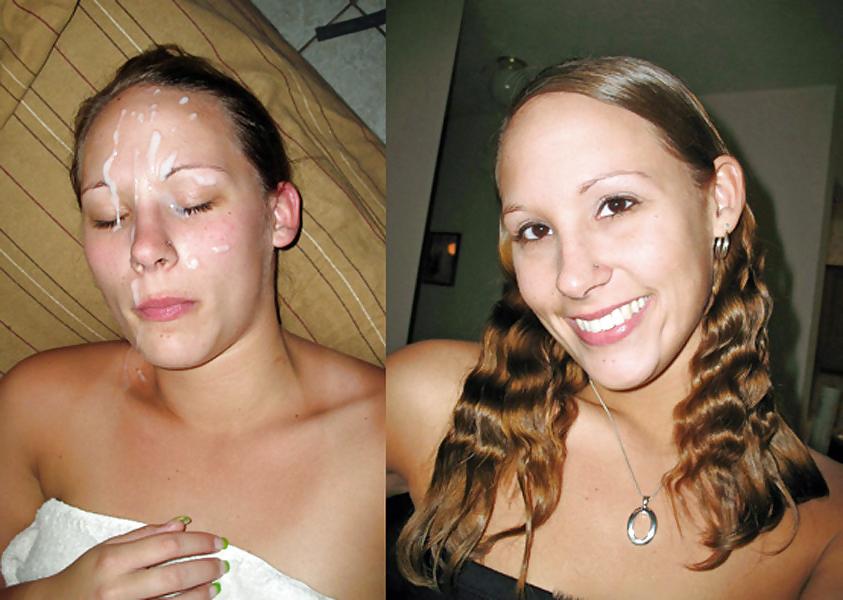 25P Before And After Facials