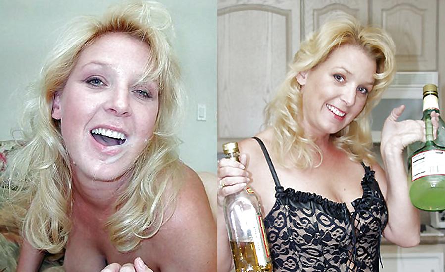 25P Before And After Facials