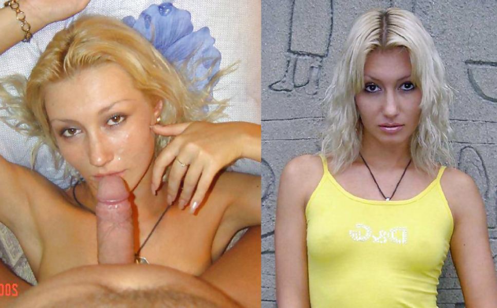 25P Before And After Facials