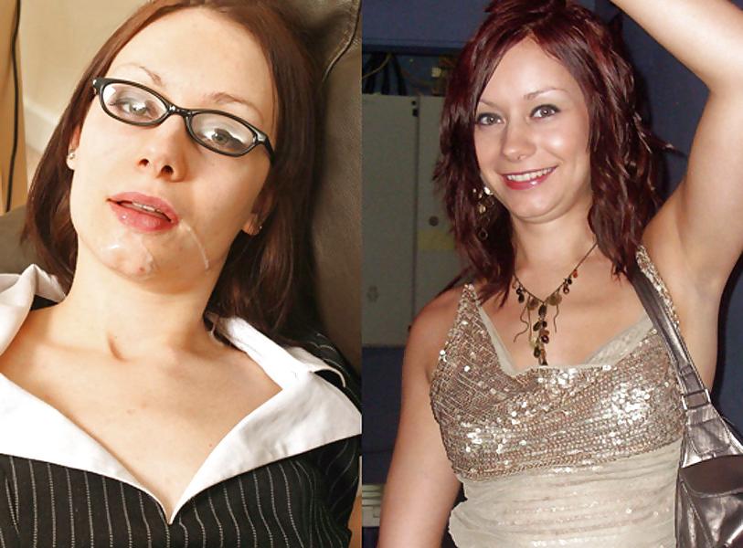 25P Before And After Facials
