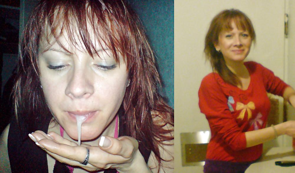 25P Before And After Facials