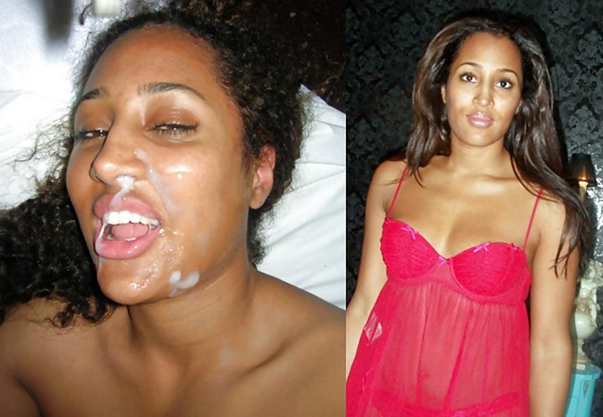25P Before And After Facials