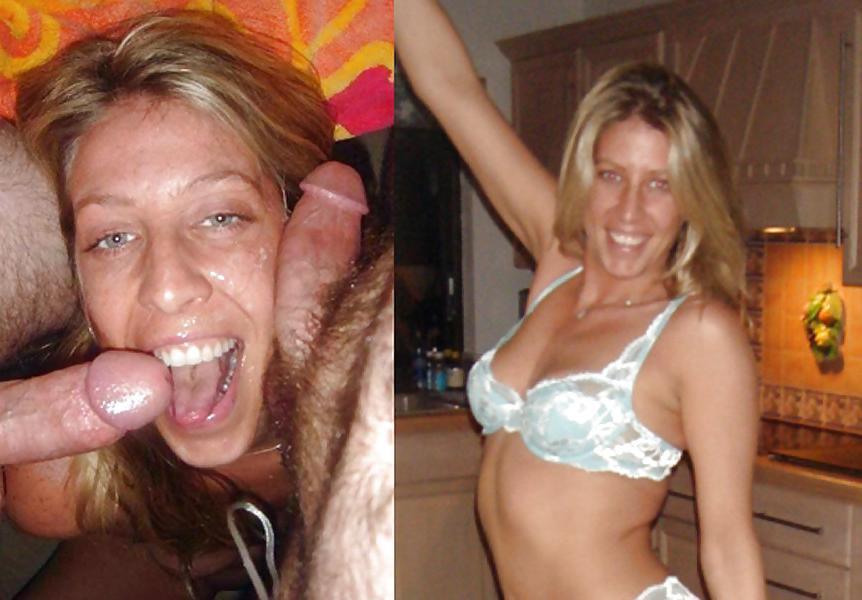25P Before And After Facials
