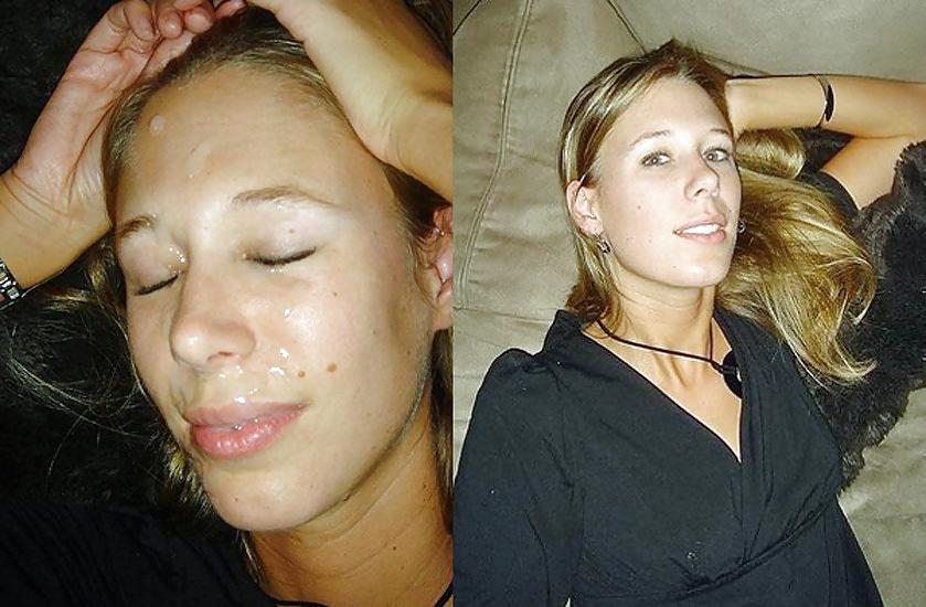 25P Before And After Facials