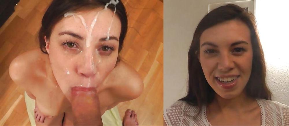 25P Before And After Facials
