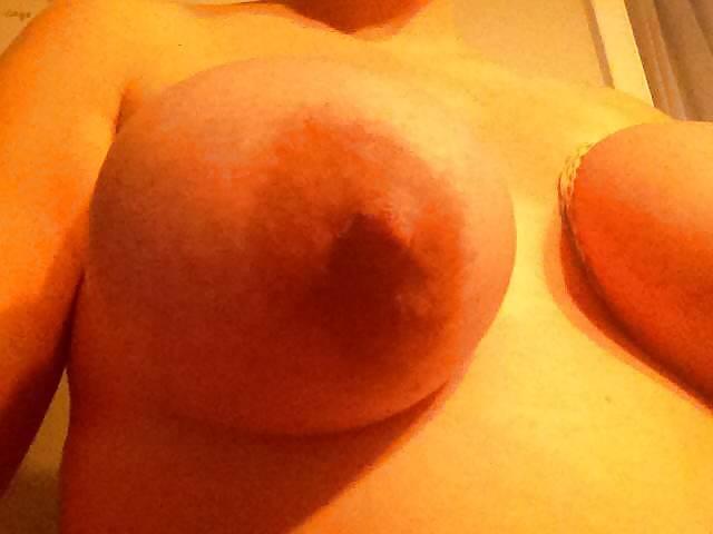 22P Bound udders
