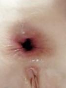 18P Anal Gape Pics