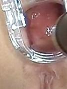 18P Anal Gape Pics