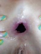 18P Anal Gape Pics