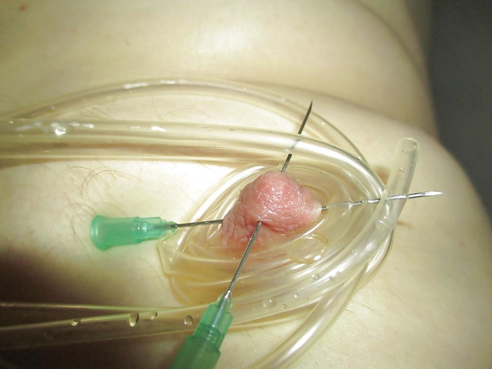 12P Pierced balls with 2 liters of saline