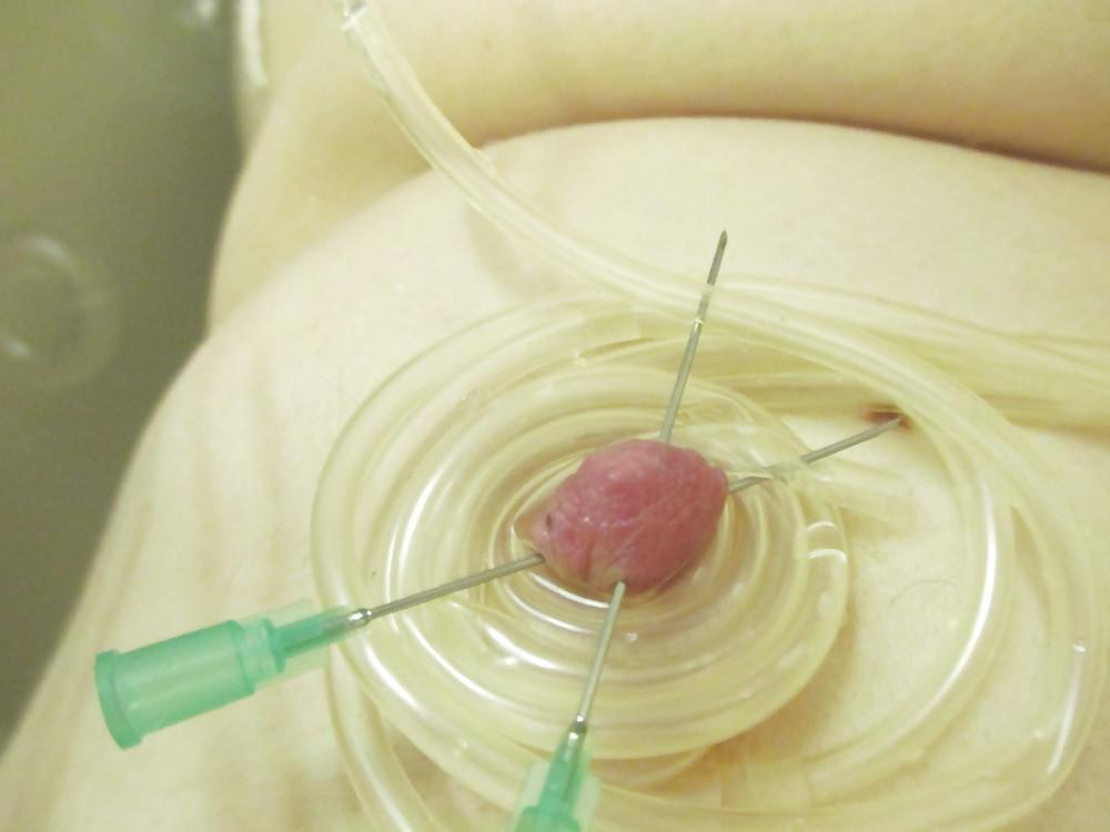 12P Pierced balls with 2 liters of saline