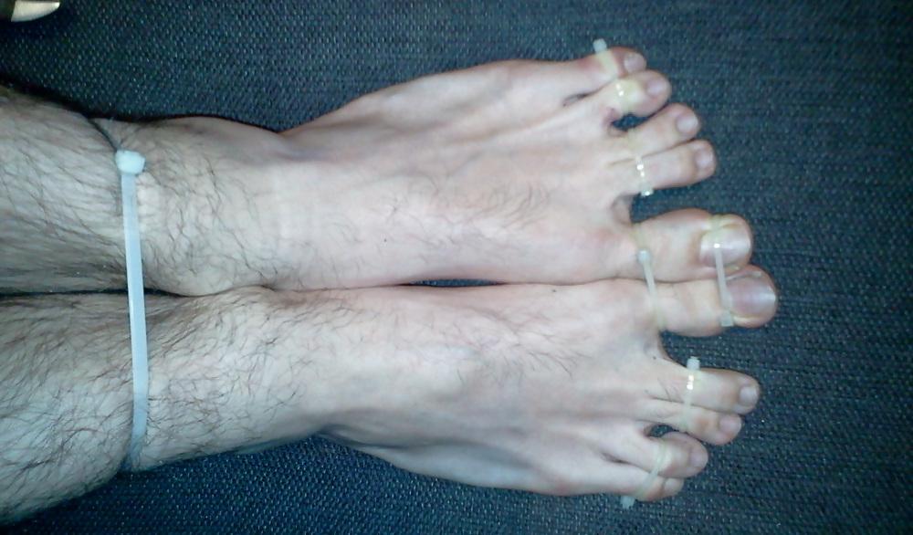 15P Bound feets