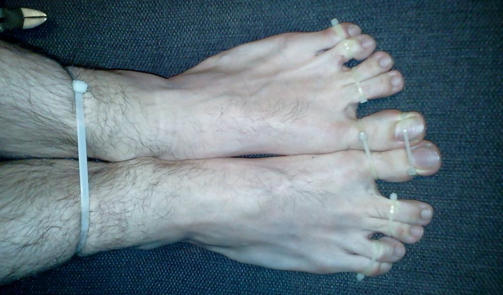 15P Bound feets