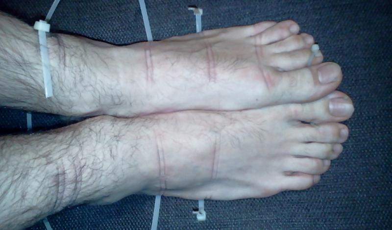 15P Bound feets