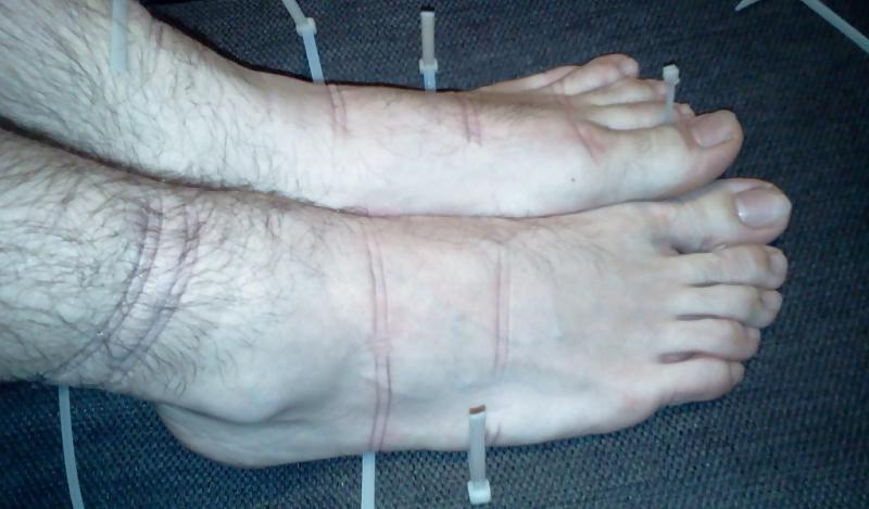15P Bound feets